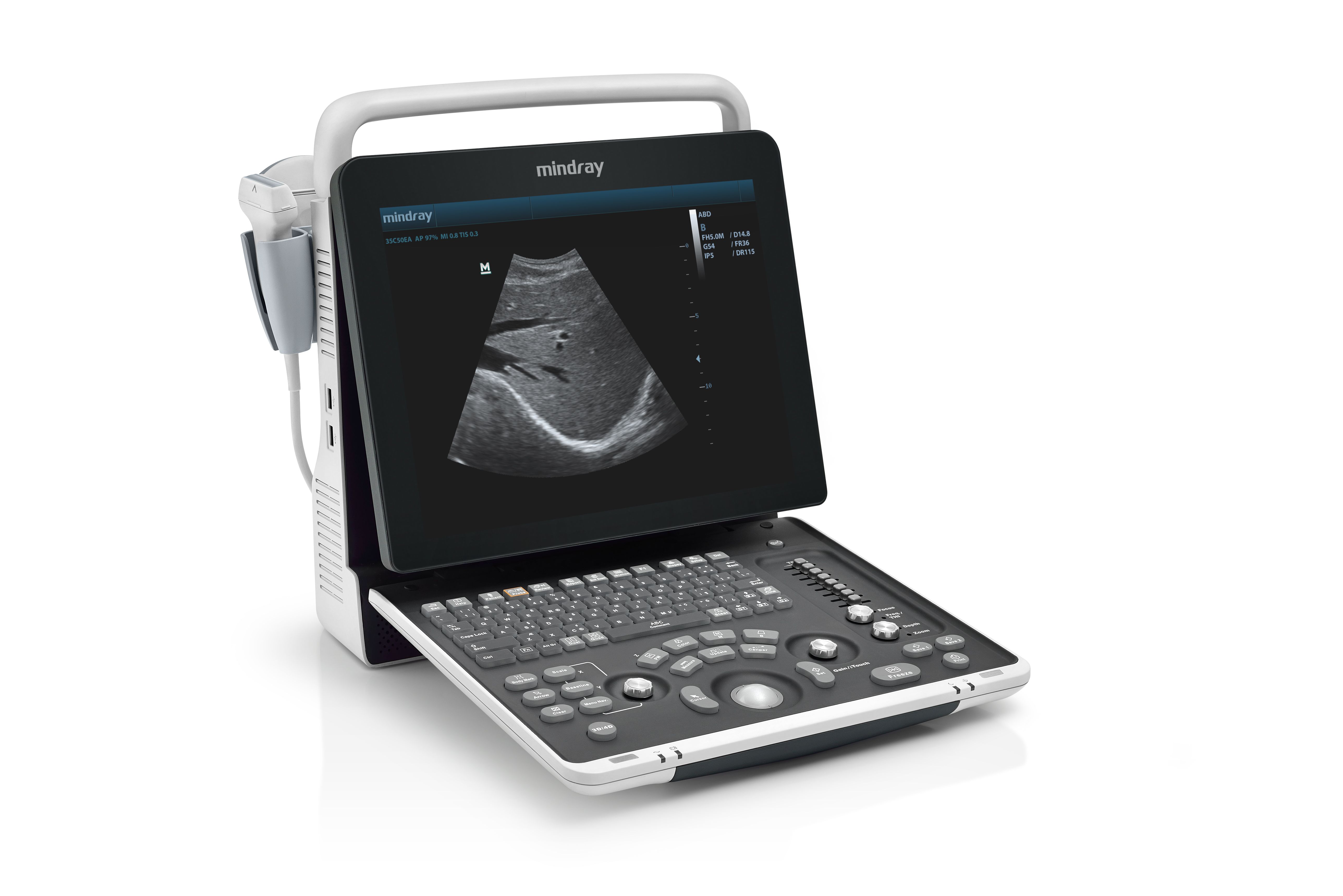 Mindray DP-50