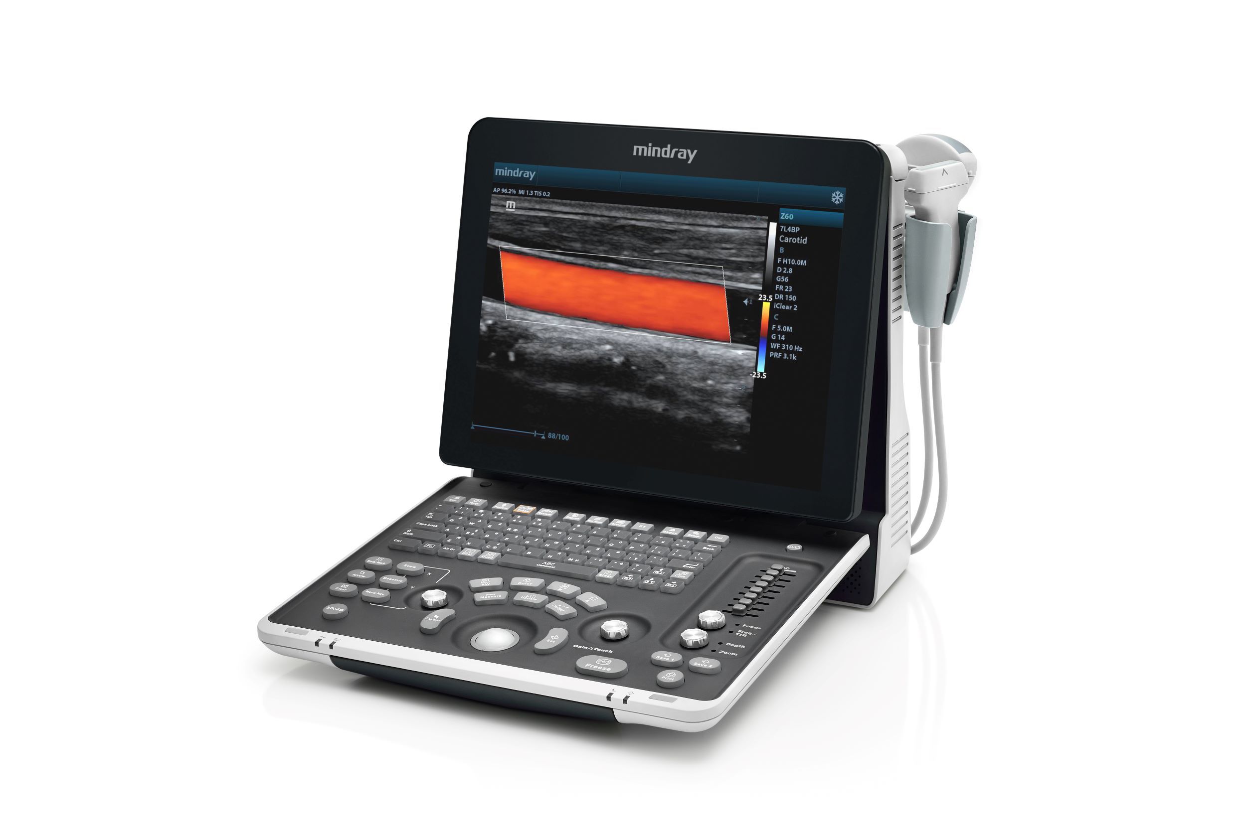 Mindray Z60