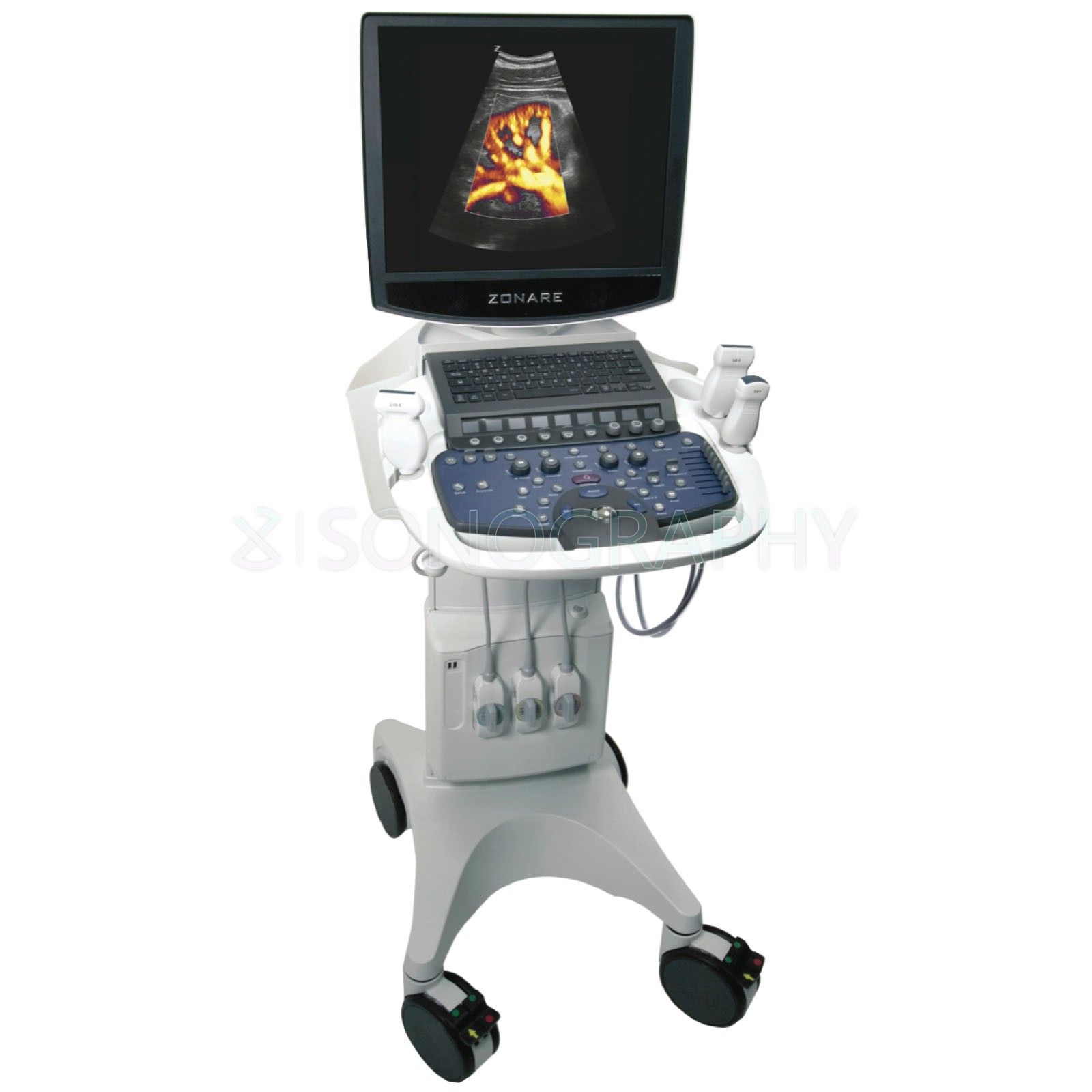 Mindray ZS3