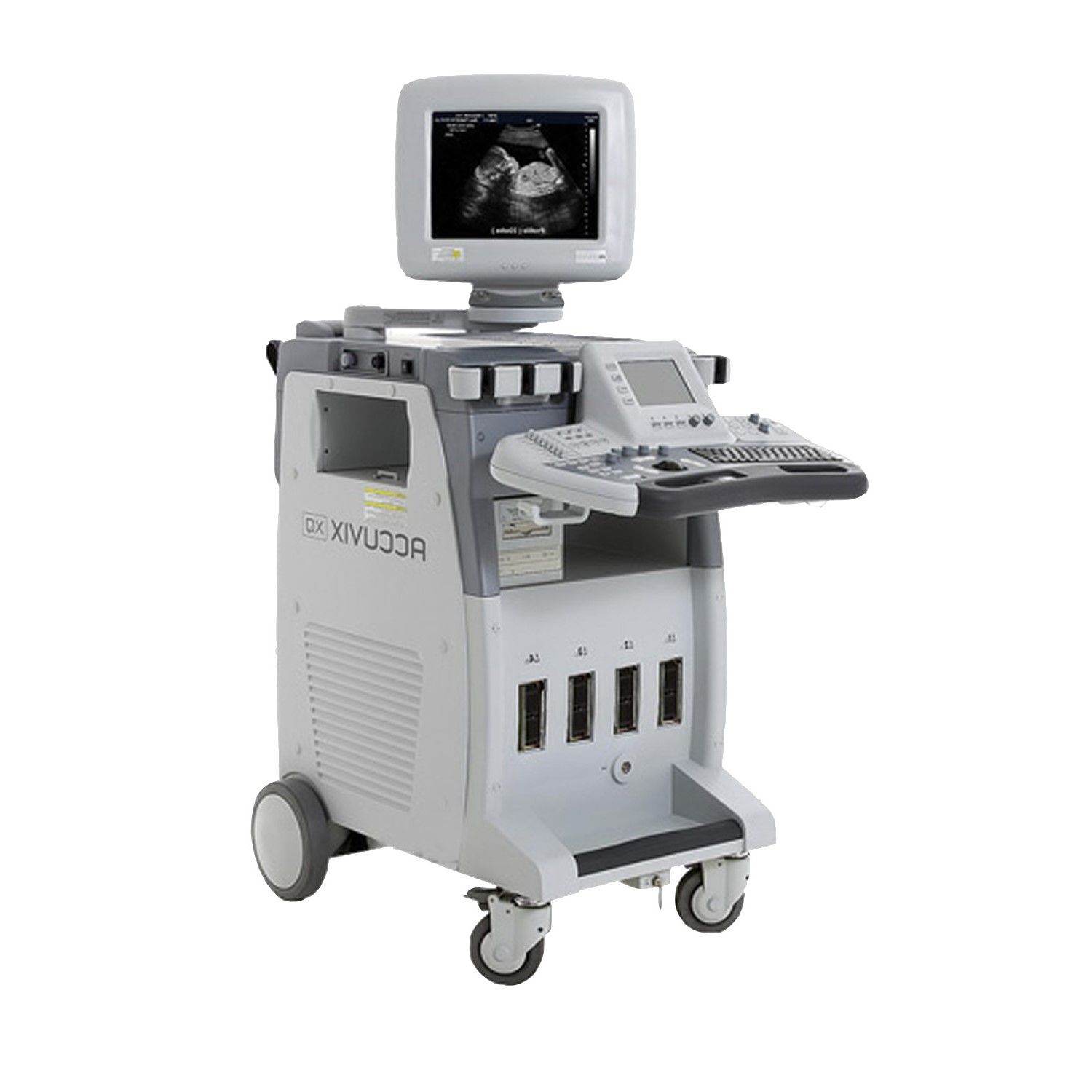 Medison Accuvix XQ